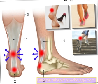 Figure Achilles tendonitis