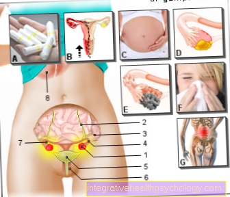 Ilustrace bolest vaječníků