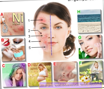 Figure eczema on the face
