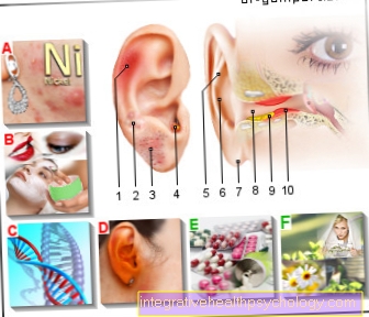 الشكل الأكزيما في الأذن