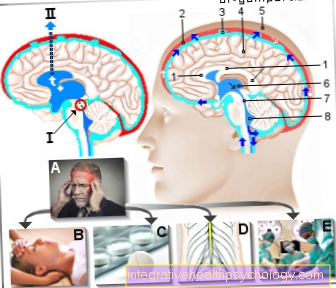 Figure Increased intracranial pressure