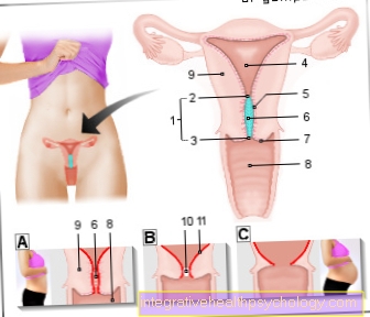 Figure cervix