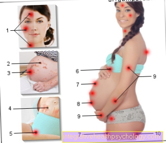 Illustration rash in pregnancy