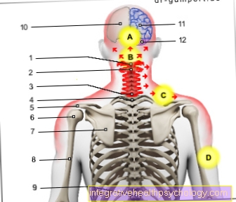 Рисунок синдром шейного отдела позвоночника