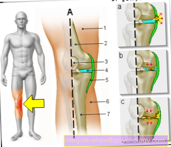 Figure knee pain on the inside