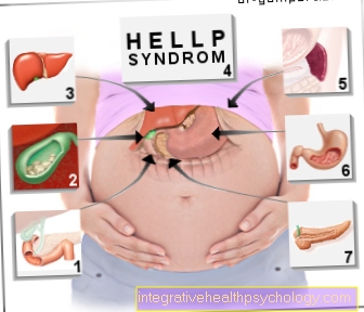 Figura Dolore addominale superiore durante la gravidanza