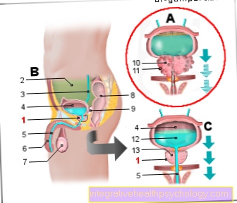 Илюстрация на рак на простатата