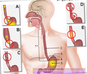 Figure pain in the esophagus