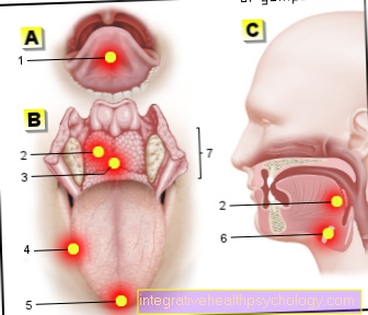 Figure douleur sur la langue