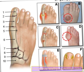 Illustration pain in the big toe
