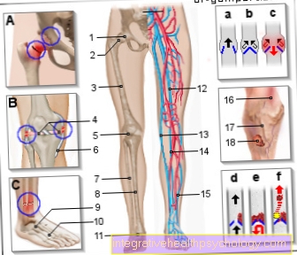 Ilustracija bolovi u nogama