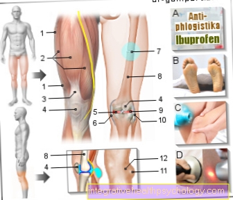 Slika bolečine nad kolenom