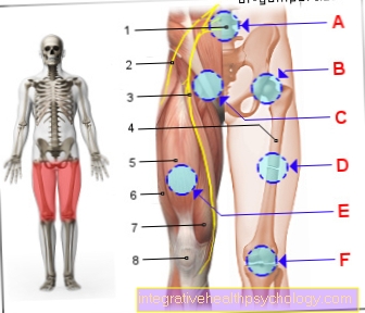 Obrázok bolesť predného stehna