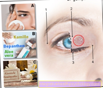 Figure dry eyelids