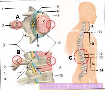 Figure vertebral fracture