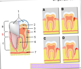 Illustration tooth neck pain
