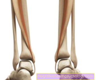 Tibialis posterior tendon