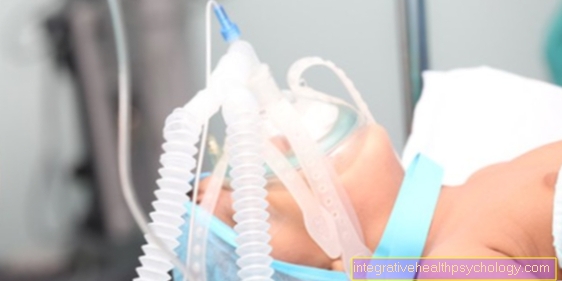 Intubation anesthesia