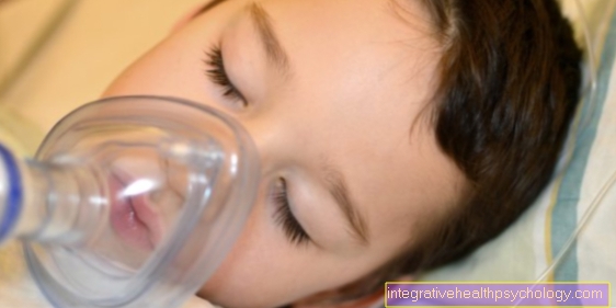 General anesthesia in children