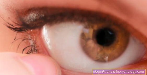 Eyelid swelling