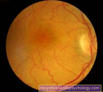 Gangguan peredaran darah pada retina