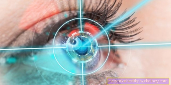 Laser therapy for presbyopia