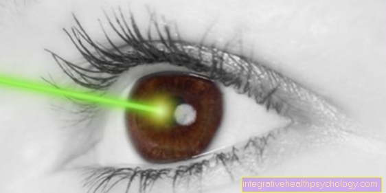 Terapia a laser para astigmatismo