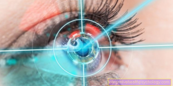 Laser therapy for myopia