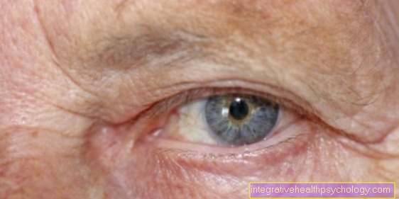Operate drooping eyelids? - You should know that!