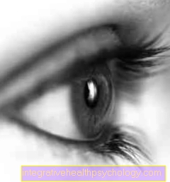 Cataract symptoms