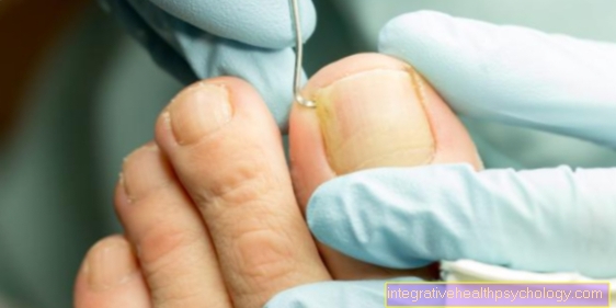 Behandling av inflammation i nagelsängen