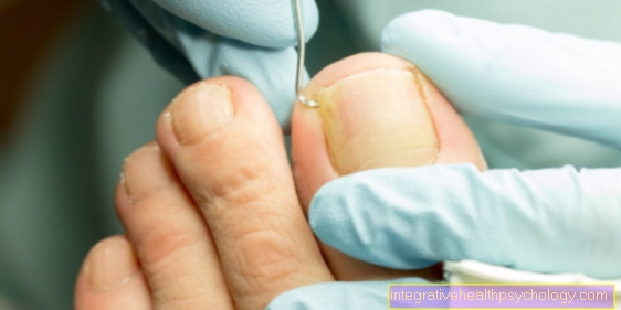 Surgery for a nail bed inflammation
