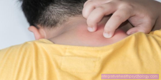 Abscess in the neck