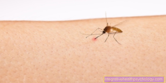 Du kan kjenne igjen et bitt fra den asiatiske tiger myggen av disse symptomene