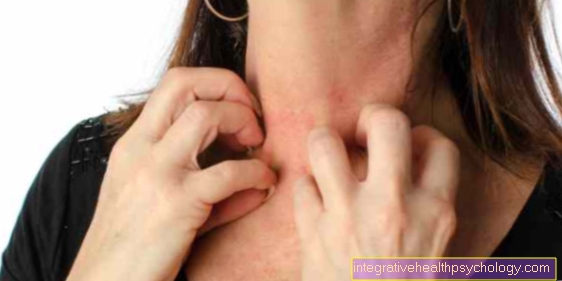 You can recognize atopic dermatitis by these symptoms