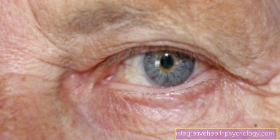 A szem basalioma