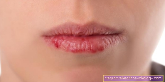 Pekoče ustnice