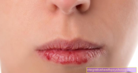 הגורמים השכיחים ביותר לשפתיים יבשות