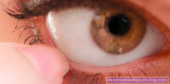 Picadura de mosquito en el ojo