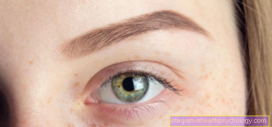 Atopični dermatitis očesa