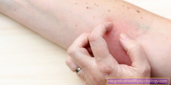 Atopisk dermatit och psoriasis - vad är skillnaden?