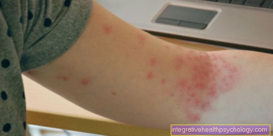Red spots on the arms - warning sign or harmless?