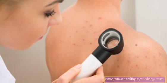 Come riconoscere il cancro della pelle