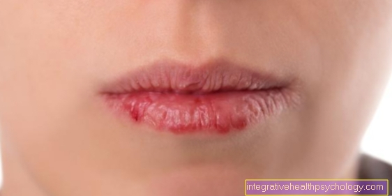Dry lips in summer