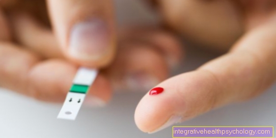 Glükoositaluvuse test - milleks see on ette nähtud?