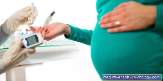 Тест на толерантність до глюкози при вагітності