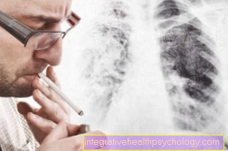 Plaučių funkcijos diagnostika sergant bronchine astma
