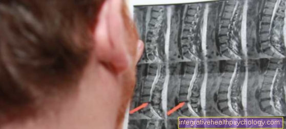 MRI of the lumbar spine