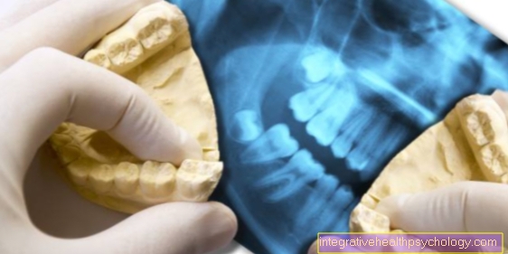 Radiografie a dinților