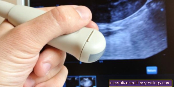 Ultrazvuk prsu